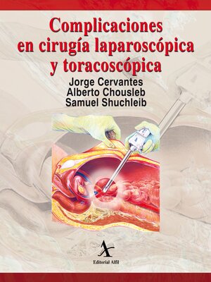 cover image of Complicaciones en cirugía laparoscópica y toracoscópica